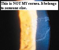 Cornea.jpg (4699 bytes)